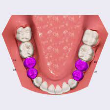 <p>Premolars (also known as “biscuspids”)</p>