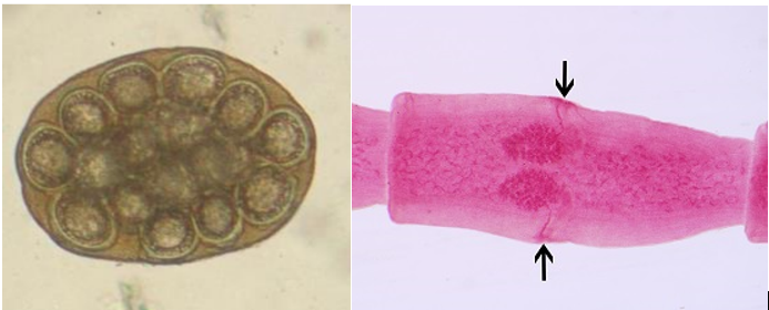 <p><strong>Egg: </strong></p><ul><li><p>small</p></li><li><p>spherical</p></li><li><p>3 thick shells</p></li><li><p>Embryonated (oncosphere)</p></li><li><p>Brown</p></li></ul><p></p><p><strong>Gravid Proglottid: </strong></p><ul><li><p>2 lateral genital pores on each side</p></li><li><p>Contain cocoons w/10-30 eggs</p></li></ul><p></p>