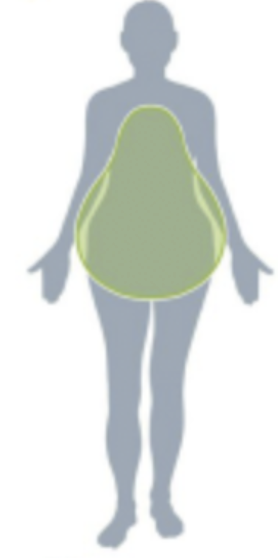 <p>Gynoid pattern</p>