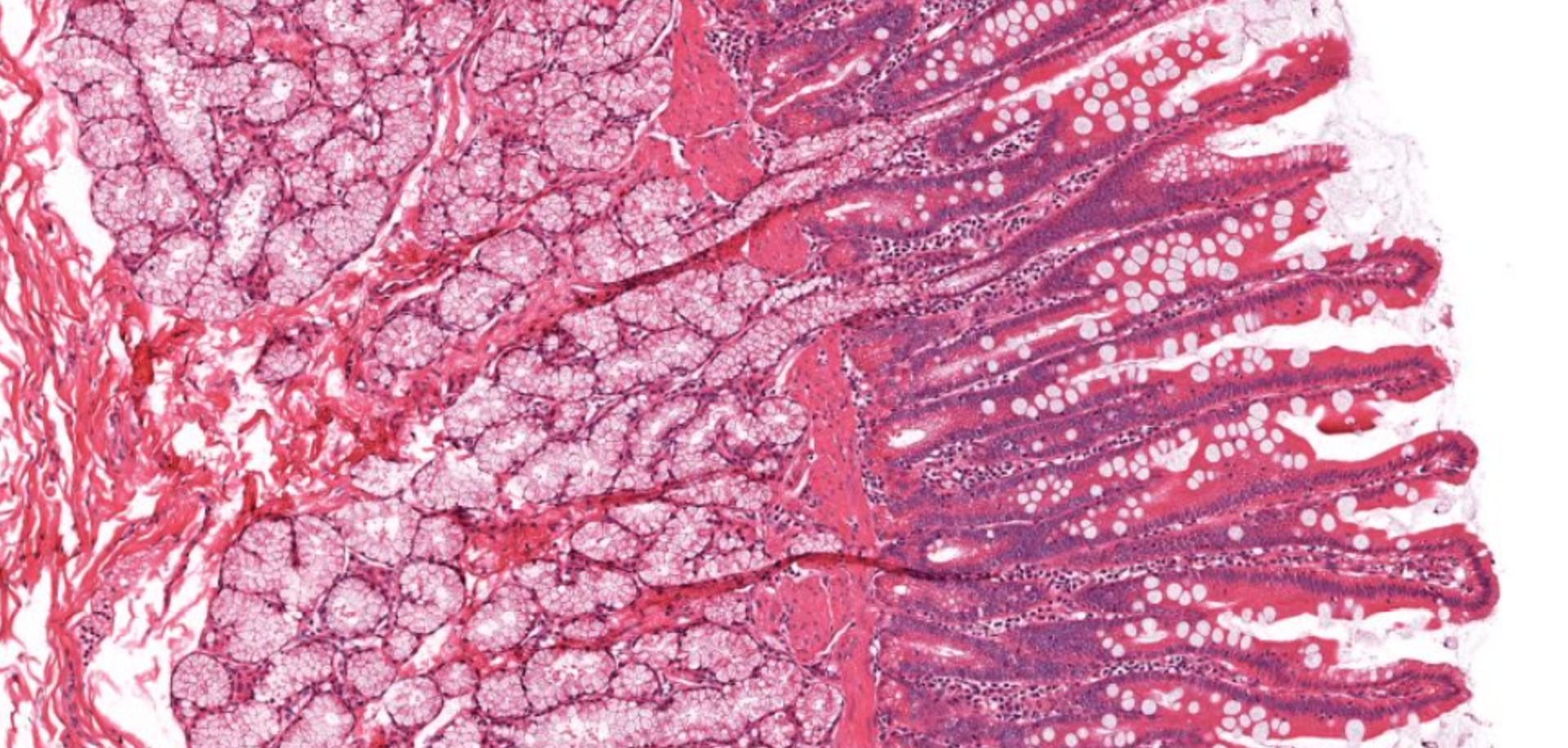 <p>which part of SI? </p>