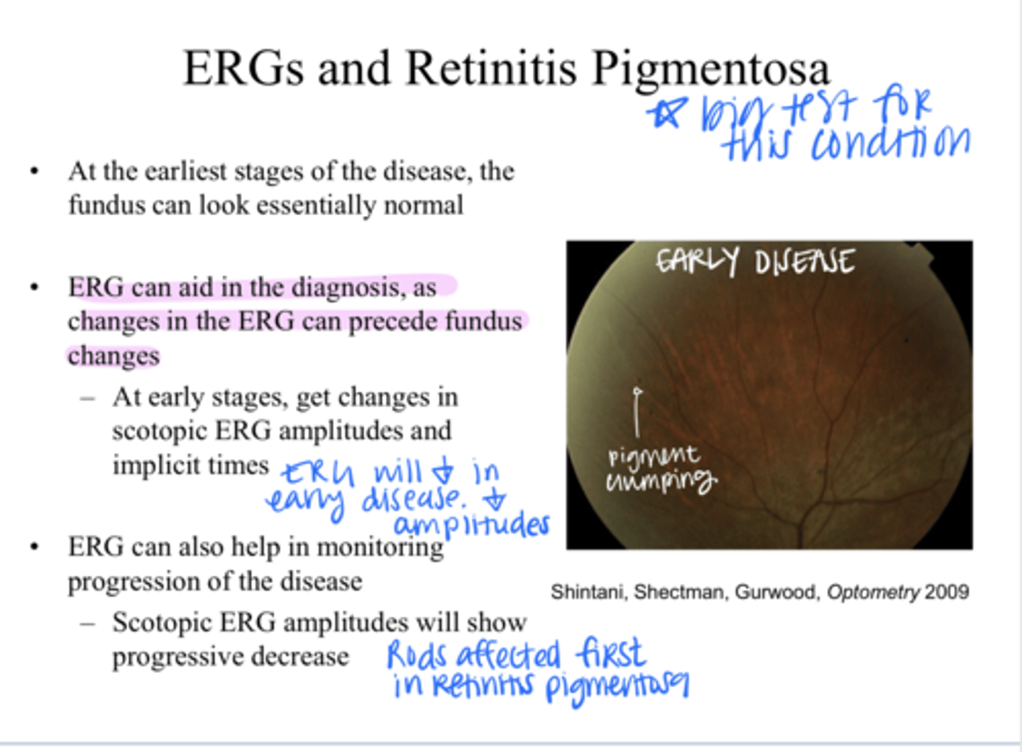 <p>What are the 1st changes on the ERG that can be detected in patients with macular degeneration?</p>