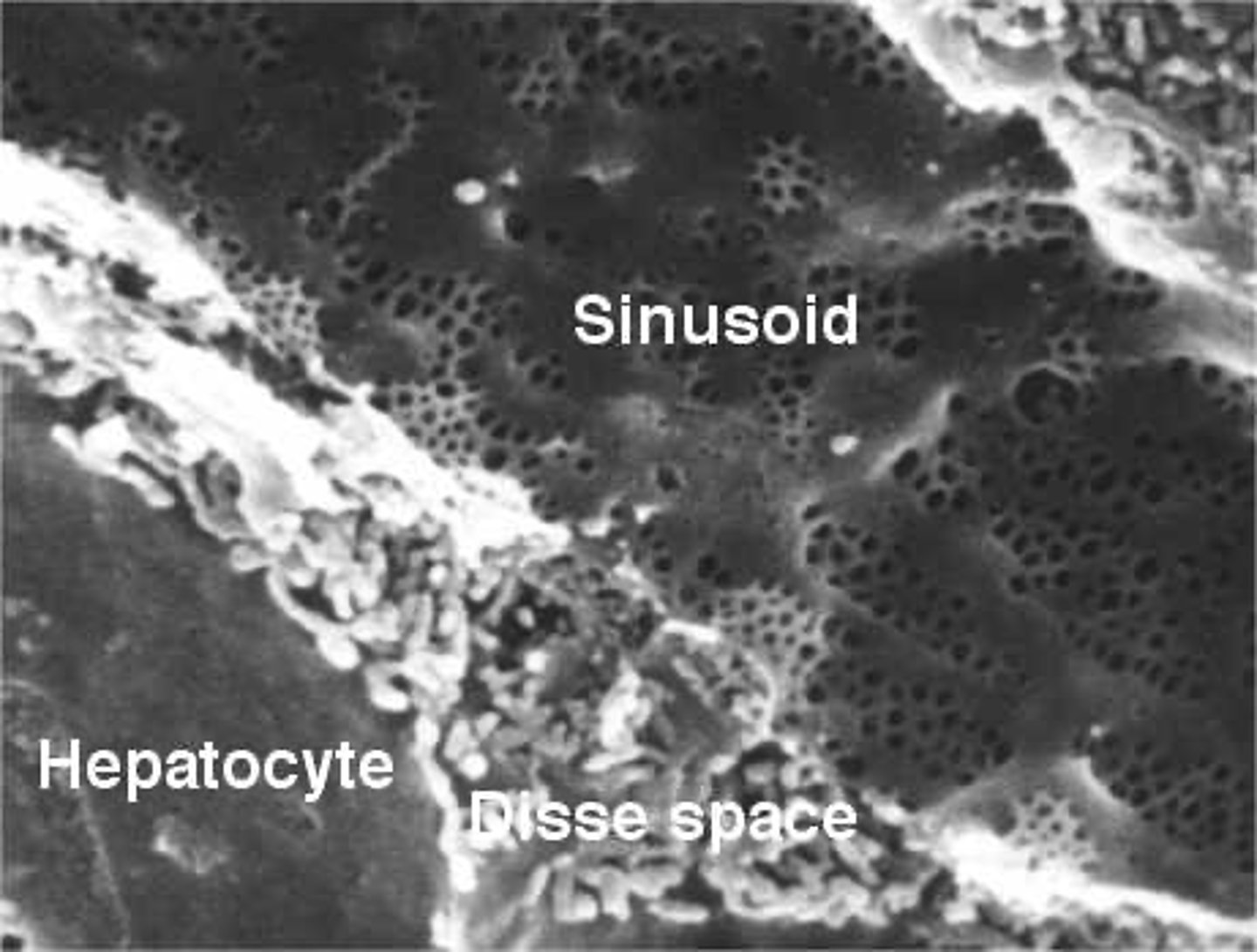 <p>SPACE OF DISSE</p><p>subendothelial space in the liver lobule between the sinusoidal lining and the hepatocytes. </p><p>hepatocytes do not directly contact the bloodstream; they exchange materials with the blood through the Space of Disse.</p>