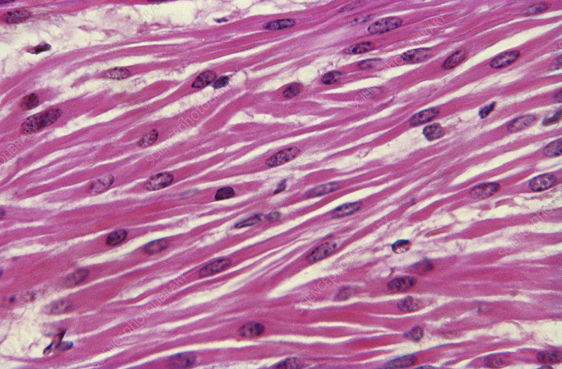 <ul><li><p>Single-centrally located nucleus.</p></li><li><p>Lack of t-tubules, myofibrils, and sarcomeres.</p></li><li><p>Non-straited appearance.</p></li><li><p>Thin and thick filaments scattered throughout the sarcoplasm joined together by dense bodies.</p></li></ul><p></p>