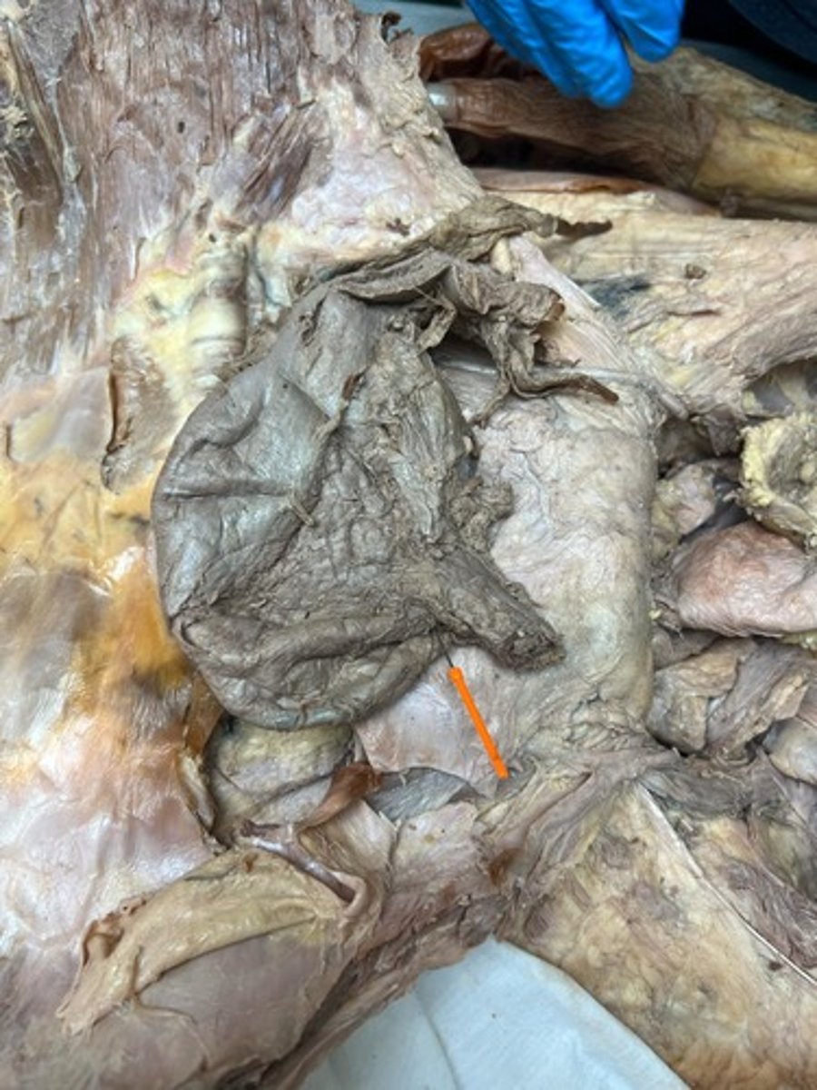 <p>cardiac notch</p>