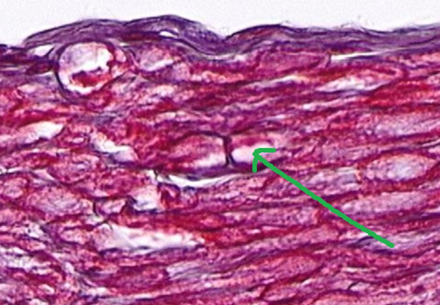 <p>composed of 80% lipids and 20% proteins and acts as a specialized membrane</p>