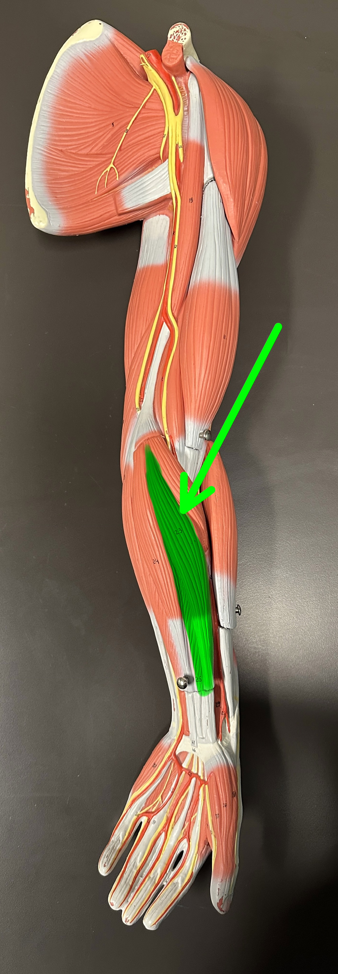 <p>What is the highlighted structure</p>