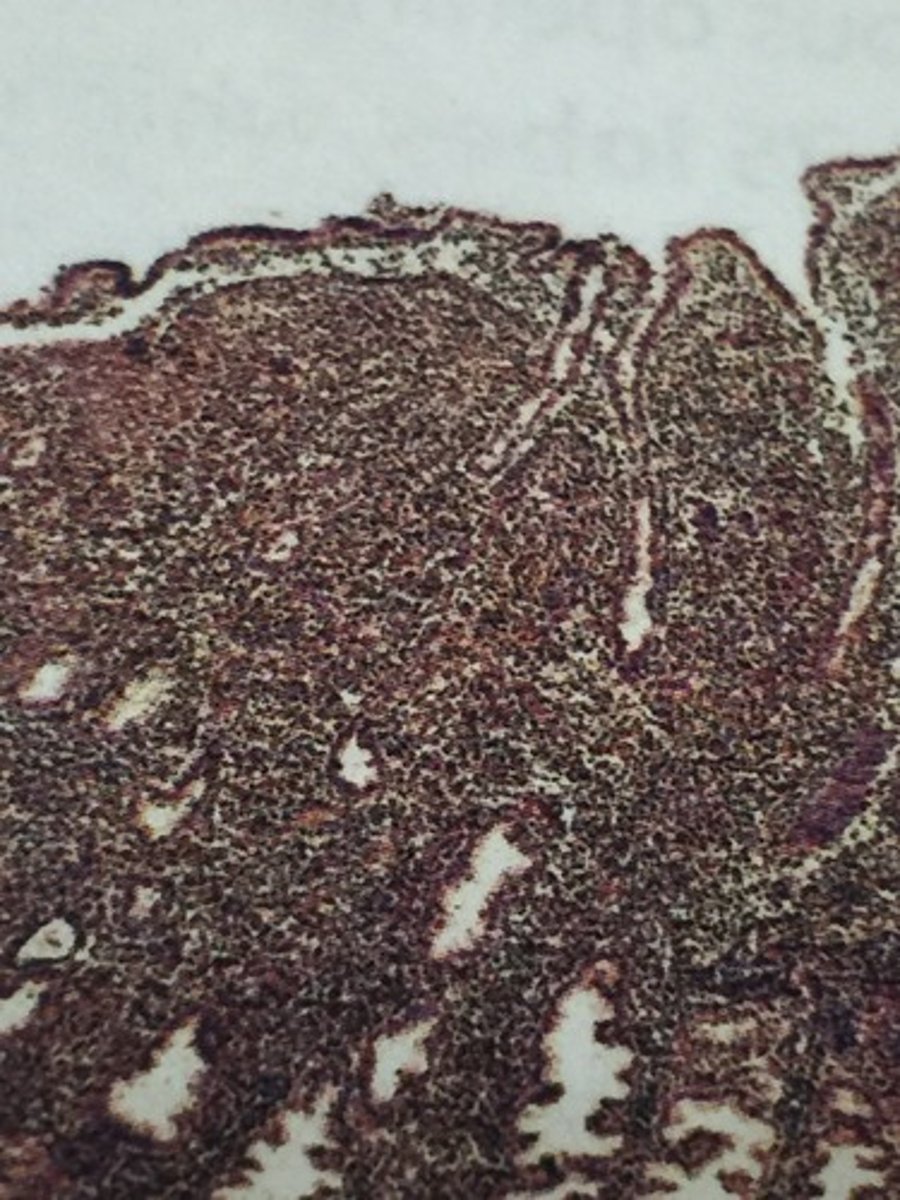 <p>This layer of the uterus lines the uterine cavity and is a highly vascular and glandular mucosa...?</p>