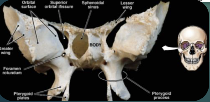 <p>Bat-shaped keystone cranial bone articulating with all other cranial bones; has greater &amp; lesser wings and pterygoid processes.</p>