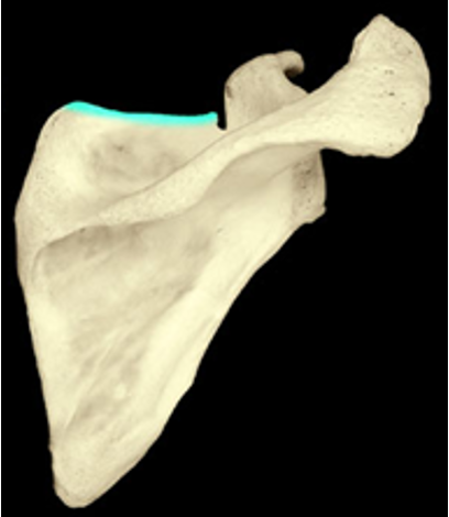 <p>The border of the scapula that stretches across the top</p>