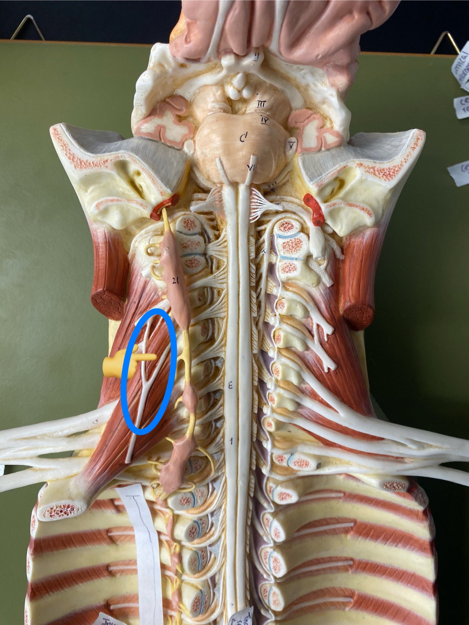 <p>ID nerve</p>