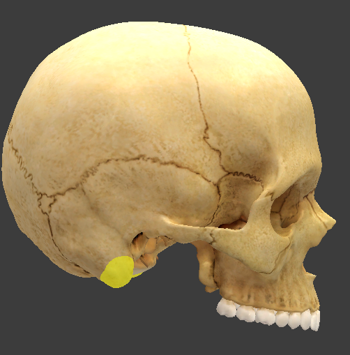 term image
