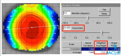 <p>How is the sagittal height for a scleral contact lens calculated?</p>