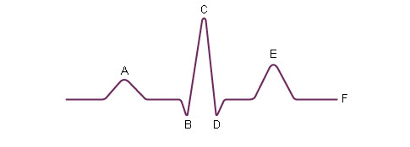 <p>(After E)</p>