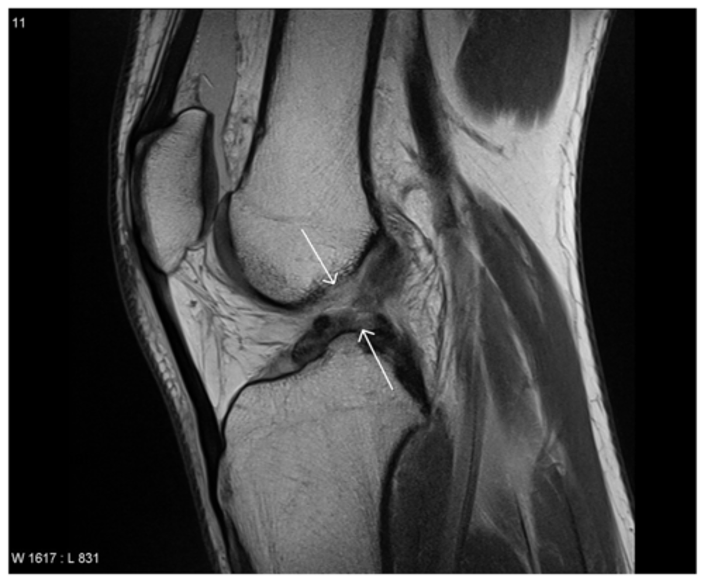 <p>Define the pathology.</p>