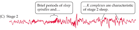 <p>Characterized by <strong>sleep spindles</strong> (brief bursts of activity) and K-complexes.</p>