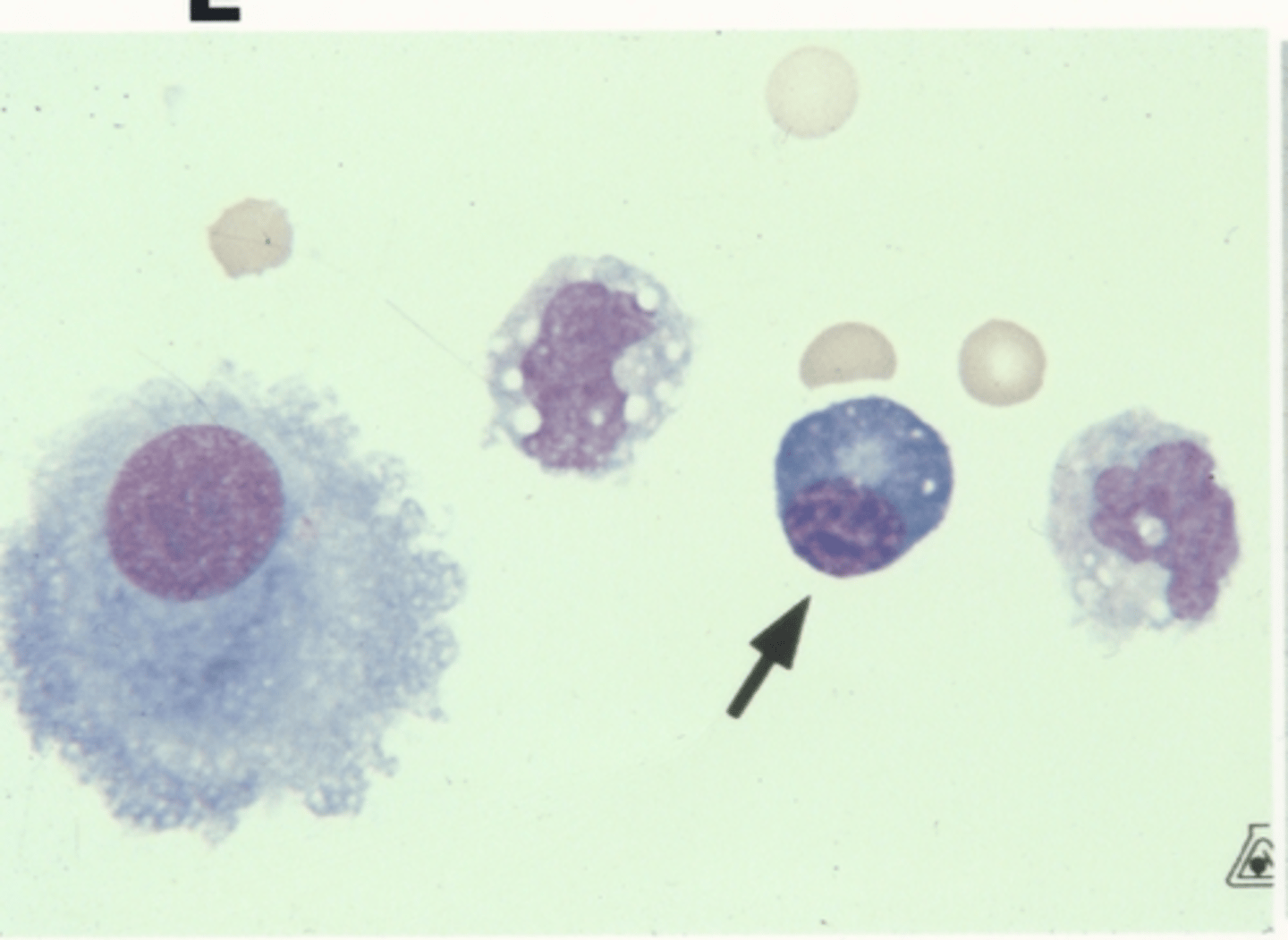 <p>Identify the cells in this body fluid</p>