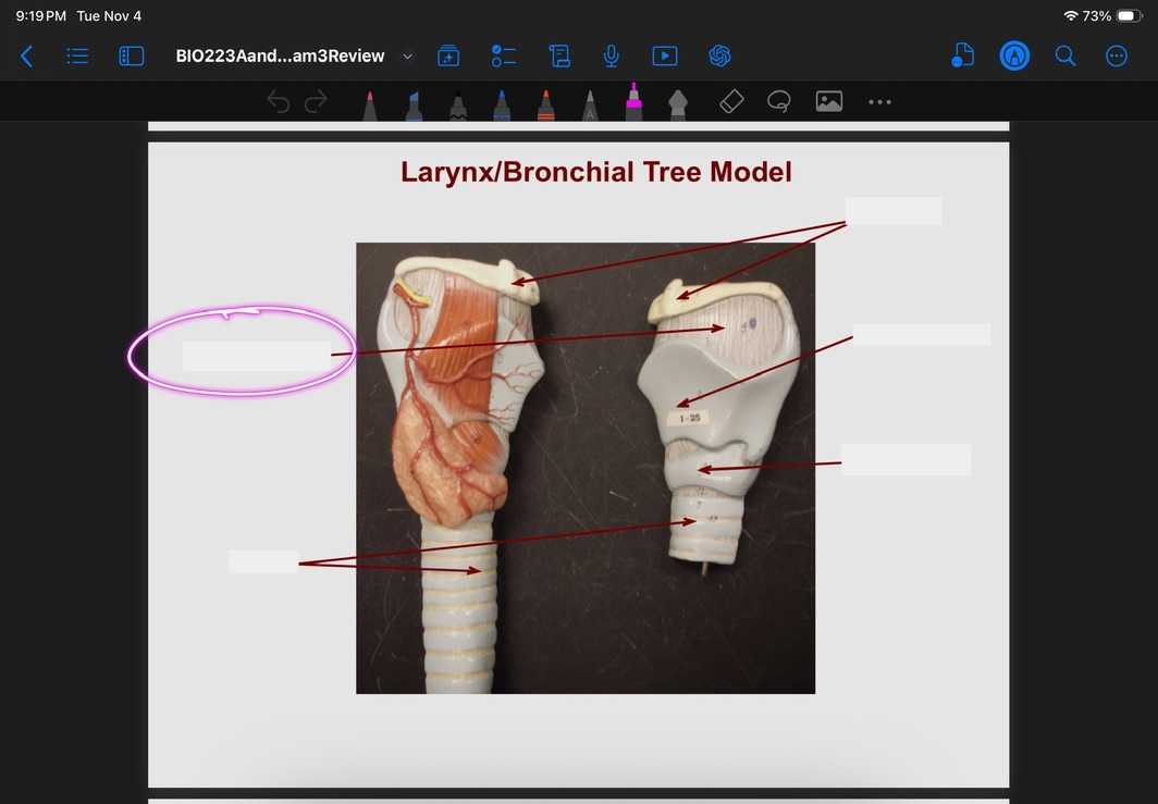 <p>What is this?</p>