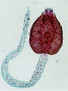 <p>Which stage is this? (trematode developmental stage)</p>