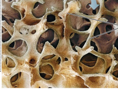 <p>what type of bone is this</p>