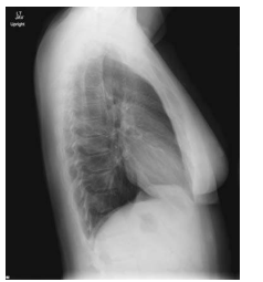 <p>What chest position is this?</p>