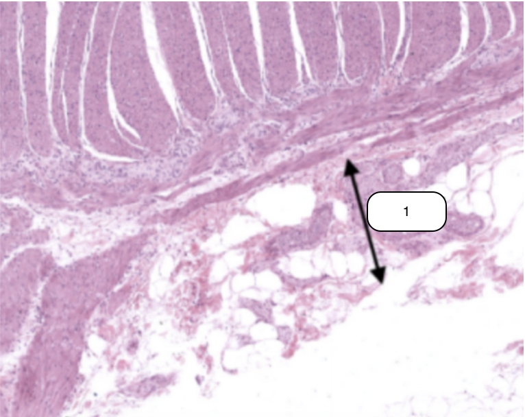 <p>Identify the structure labeled #1</p>