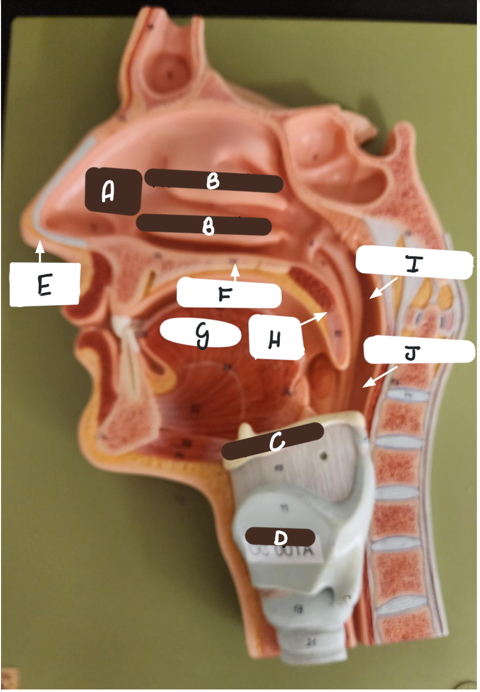 A 