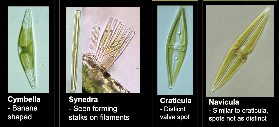 <p>What bacteria is this?</p>