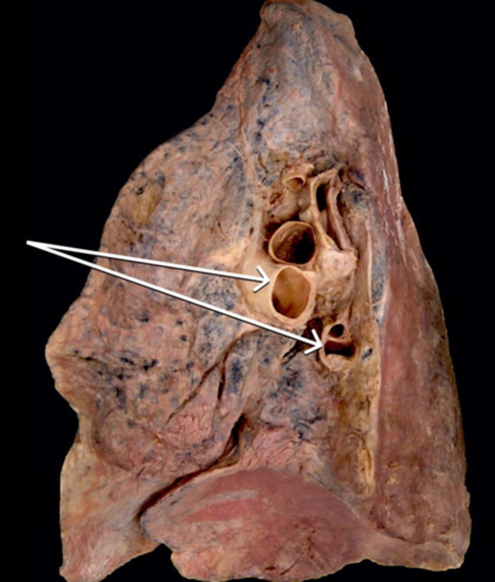 <p>Name the Veins</p>