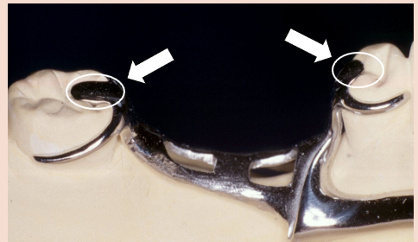 <p>Clasp Assembly six requirements:</p><p>3) Support – resistance to _______ force.</p><p>Obtained from rests</p>