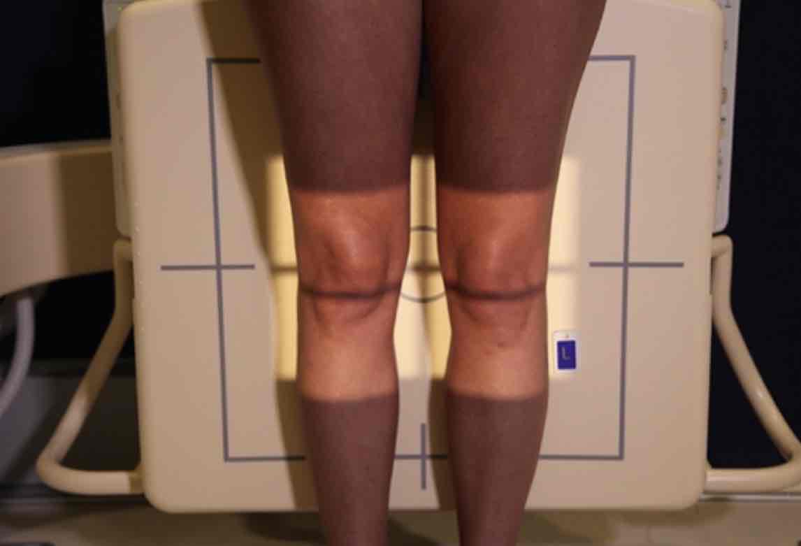 <p>What Projection is this?</p>