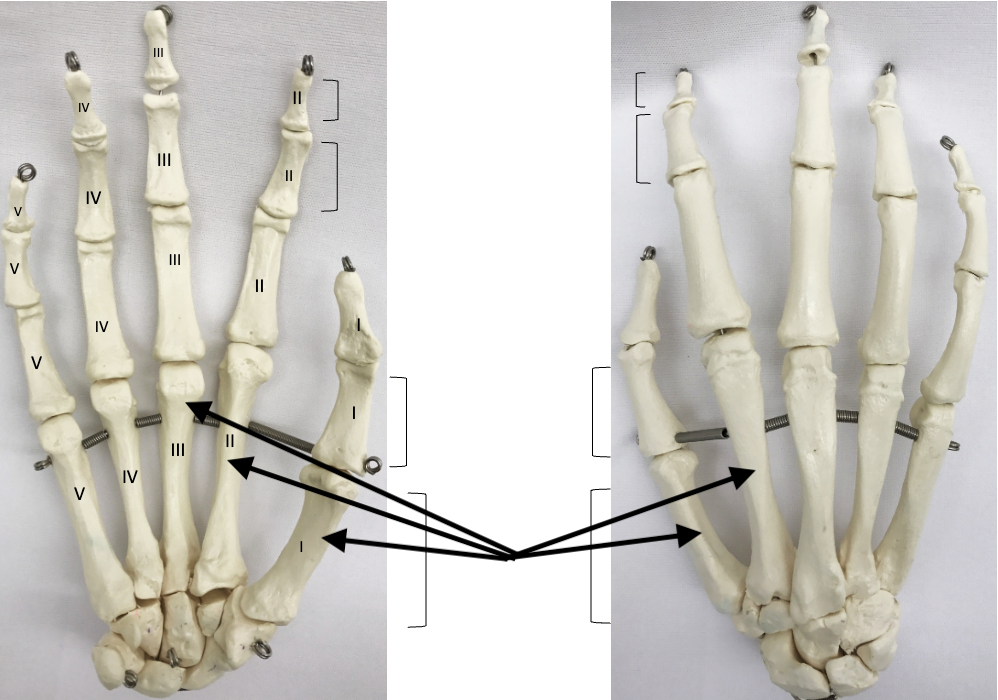 <p>What bones are these?</p>