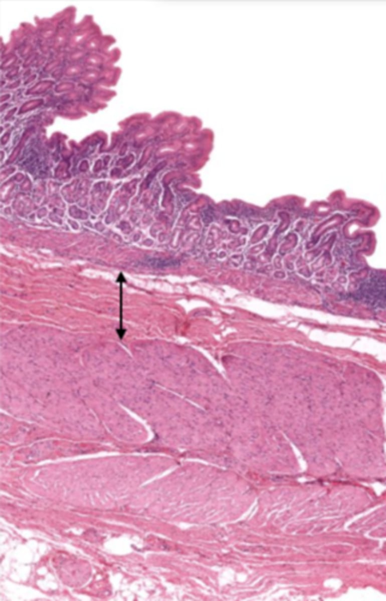 <p>contains glands and blood supply</p>
