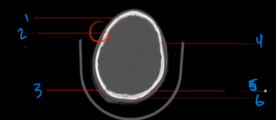 <p>Where does the occipital bone located?</p>
