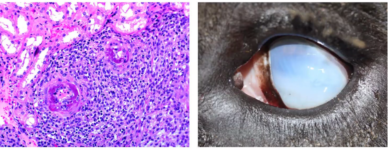 <p>What is the etiology?</p><p>A-Foot and mouth dis~ease virus</p><p>B-Bovine viral diarrhea virus</p><p>C-Papular stomatitis virus</p><p>D-Ovine herpesvirus type 2</p>