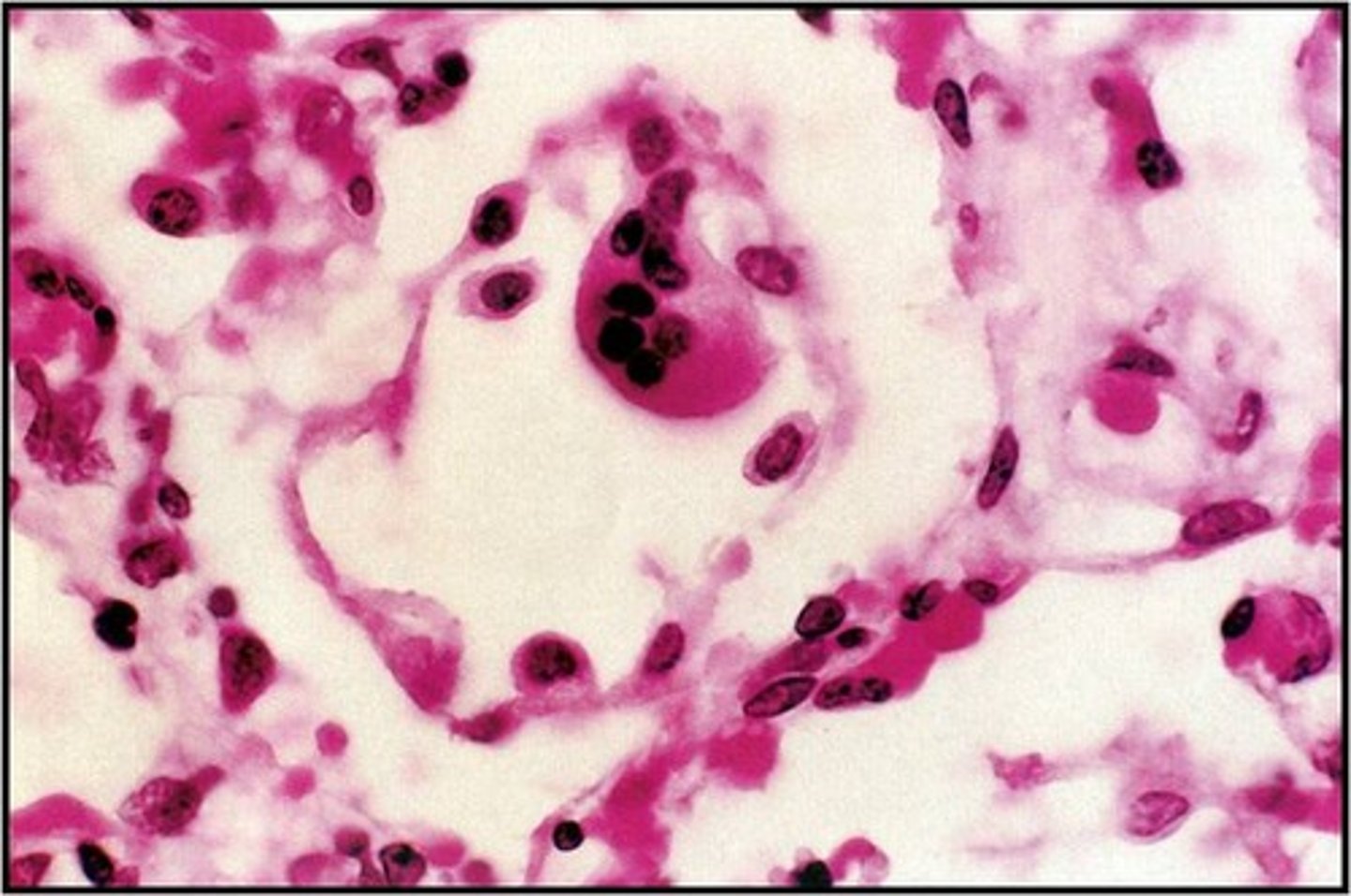 <p>envelope contains Fusion(F) protein- viral entry and syncytium formation</p><p>syncytial-giant, multinucleate cells</p>