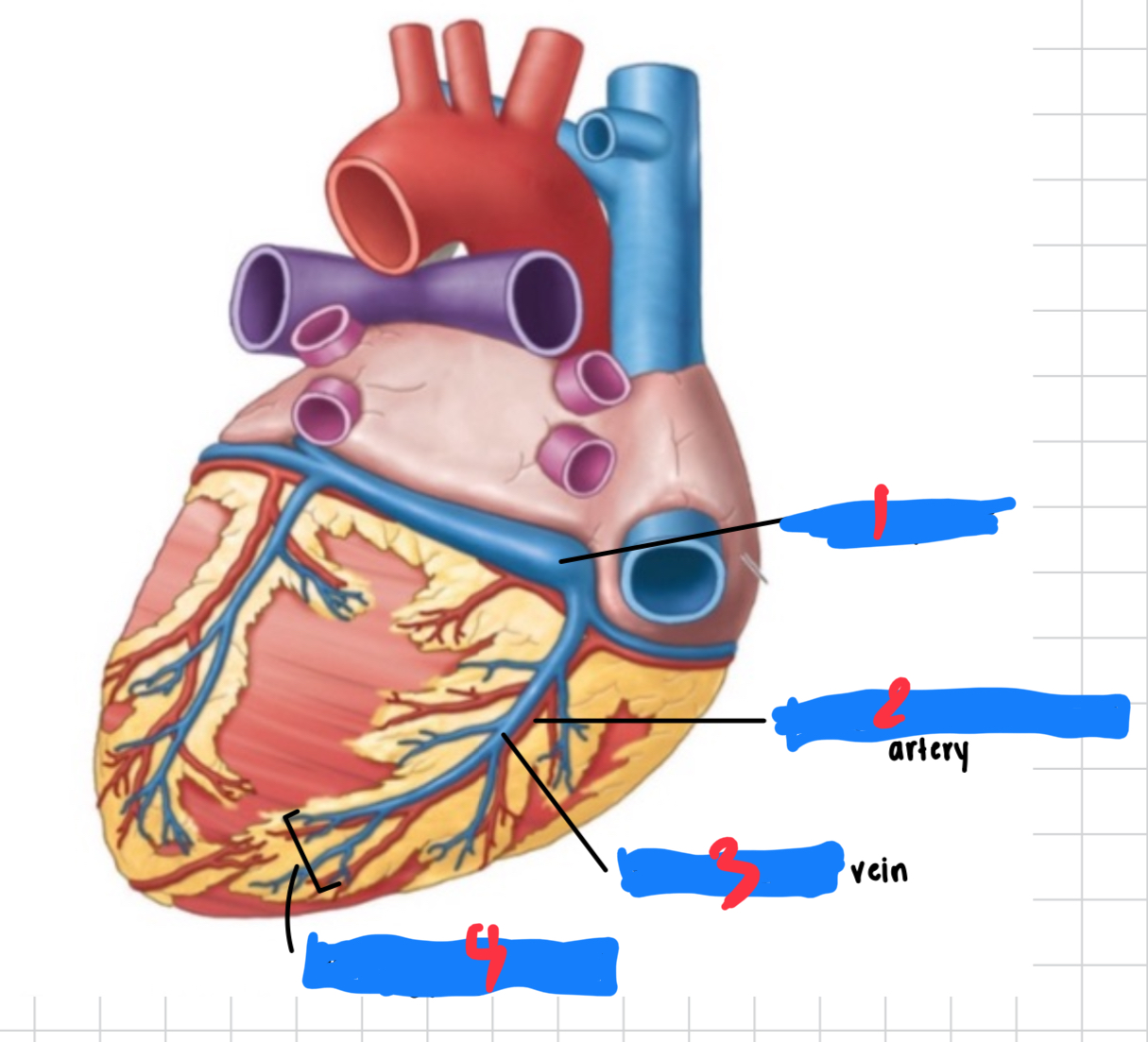 <p>2 artery</p>
