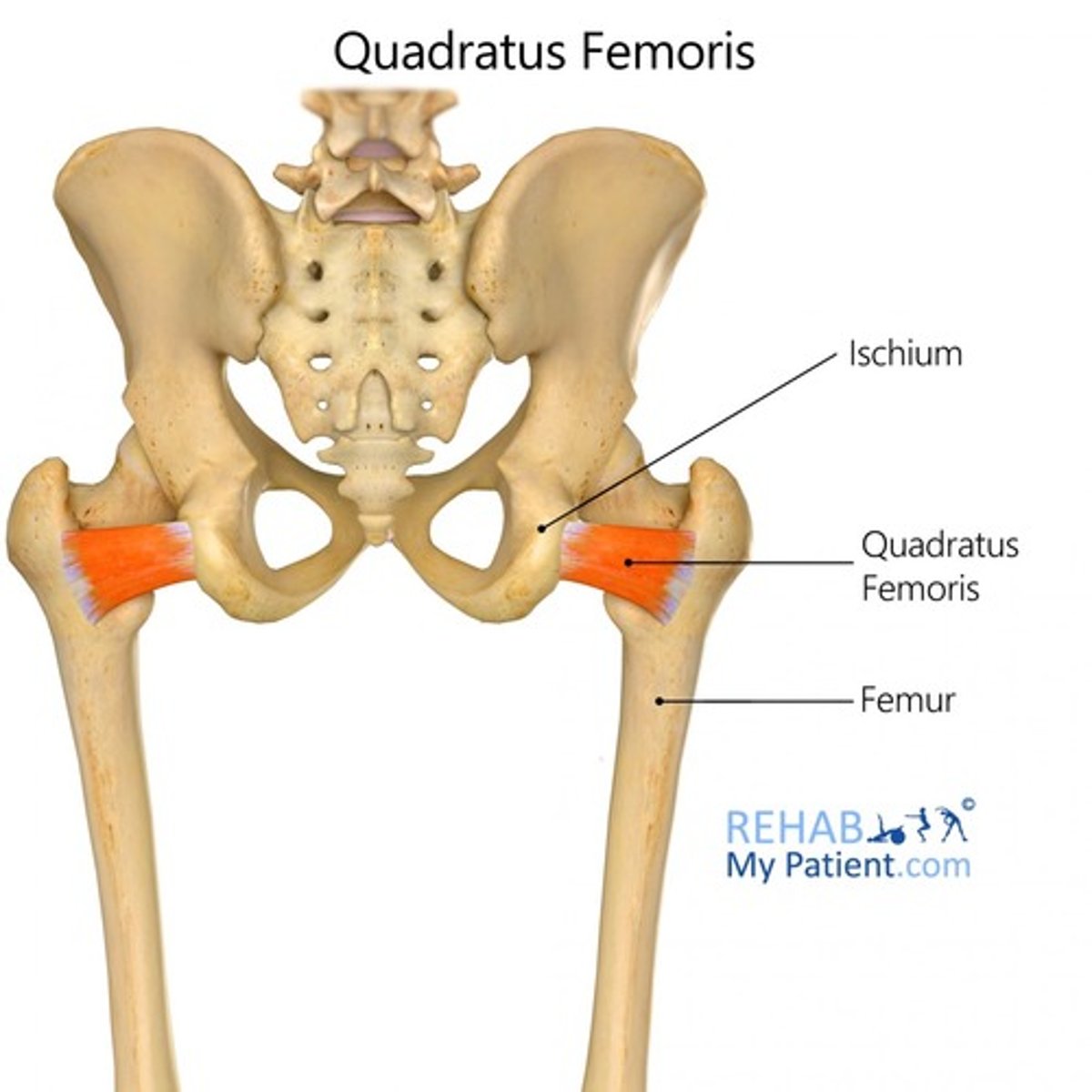 <p>origin: ischium tuberosity<br>insertion: femur, intertrochantric crest<br>action: lateral rotation at the hip</p>