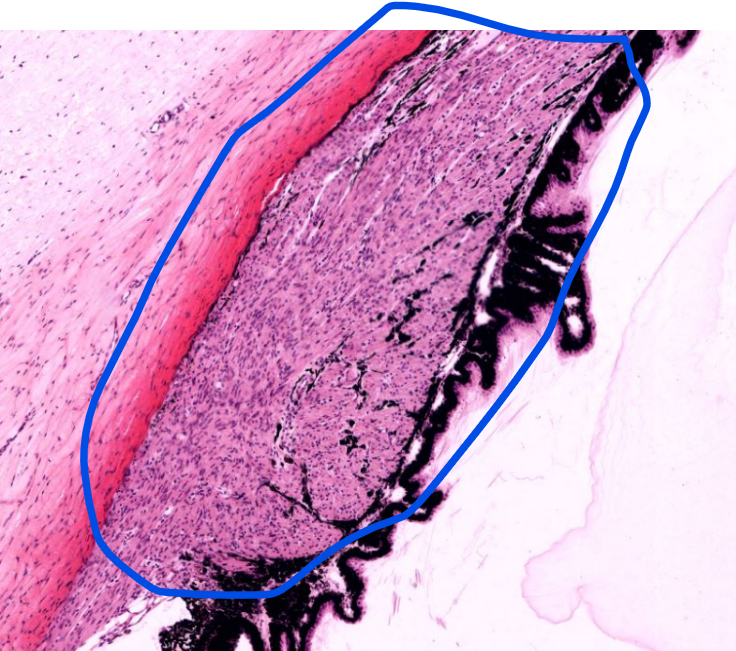 <p>structure </p>