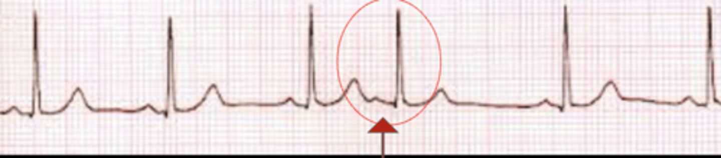 knowt flashcard image