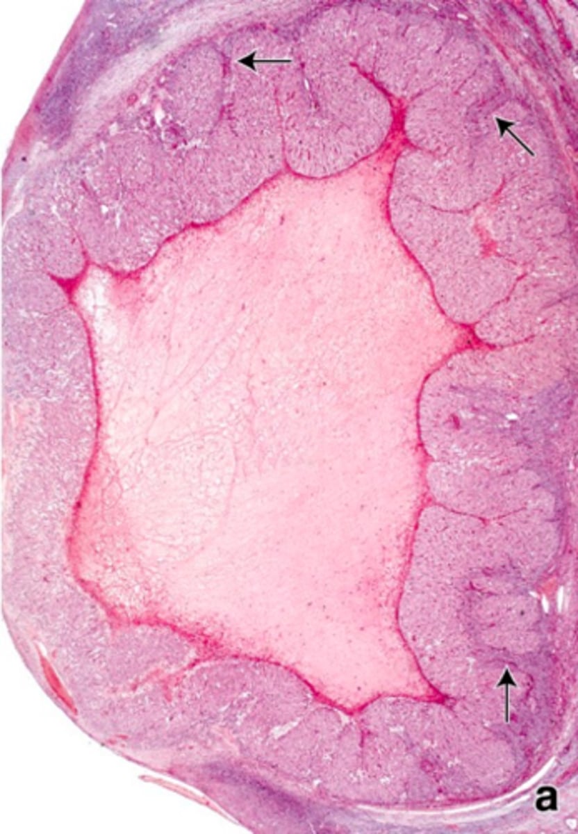 <p>ID the ovarian cell stage:</p>