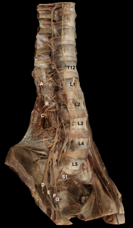 <p>A lesion of “D” will cause what impairment</p>