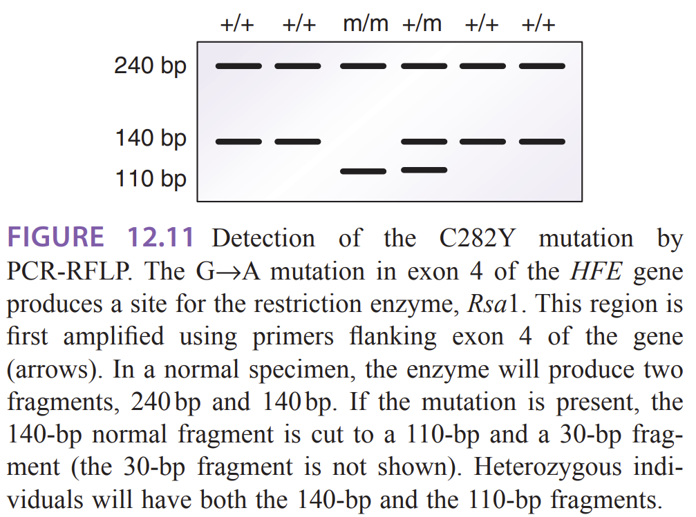 <ol><li><p>Normal (wild-type, +/+) — two fragments 240 bp and 140 bp after RsaI digestion. </p></li><li><p>Heterozygous (+/m) — shows a combination of the normal 140 bp band and the mutant 110 bp band (plus the 240 bp fragment). The 30-bp fragment from the cut 140→110+30 is usually not visible on a standard agarose gel</p></li></ol><ol start="3"><li><p>Homozygous mutant (m/m, C282Y/C282Y) — the 140-bp normal fragment is cut to 110 bp (and 30 bp not shown), so bands are 240 bp and 110 bp (no 140 bp)</p></li></ol><p></p>