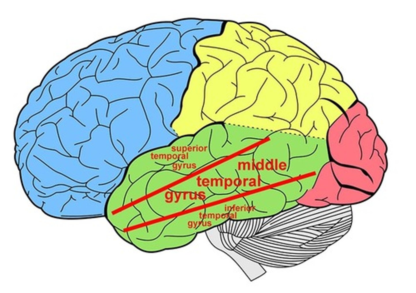 <p>- the uppermost gyrus of the temporal lobe</p><p>- involved in processing auditory information and language comprehension.</p>