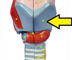 <p>What is this structure?</p><ul><li><p>formed by the joining of 2 broad plates of cartilage (“adams” apple = laryngeal prominence: anterior angle)</p></li></ul><p></p>