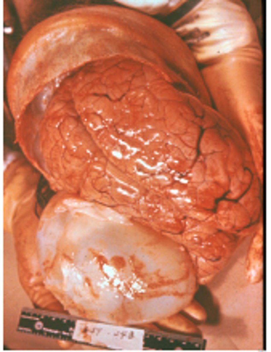 <p>Ingestion of eggs passed in the feces of an infected canine</p><p>3 multiple choice options</p>