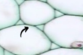 <p>Parenchyma cells</p>