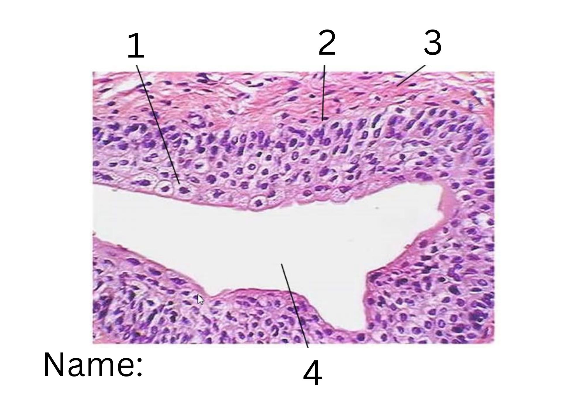 term image