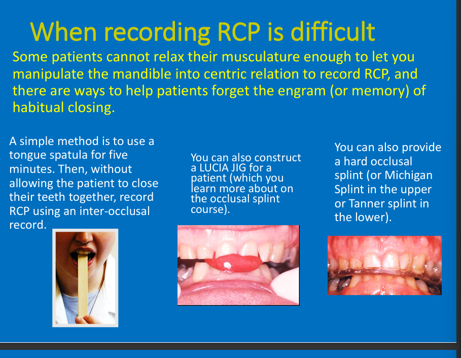 <ul><li><p>Unable to relax musculature to manipulate the mandible</p></li><li><p>Bite on spatula at angle, Lucia jig, hard occlusal splint</p></li></ul><p></p>