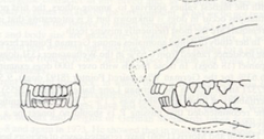 <p>What kind of bite does this dolichocephalic dog have?</p>