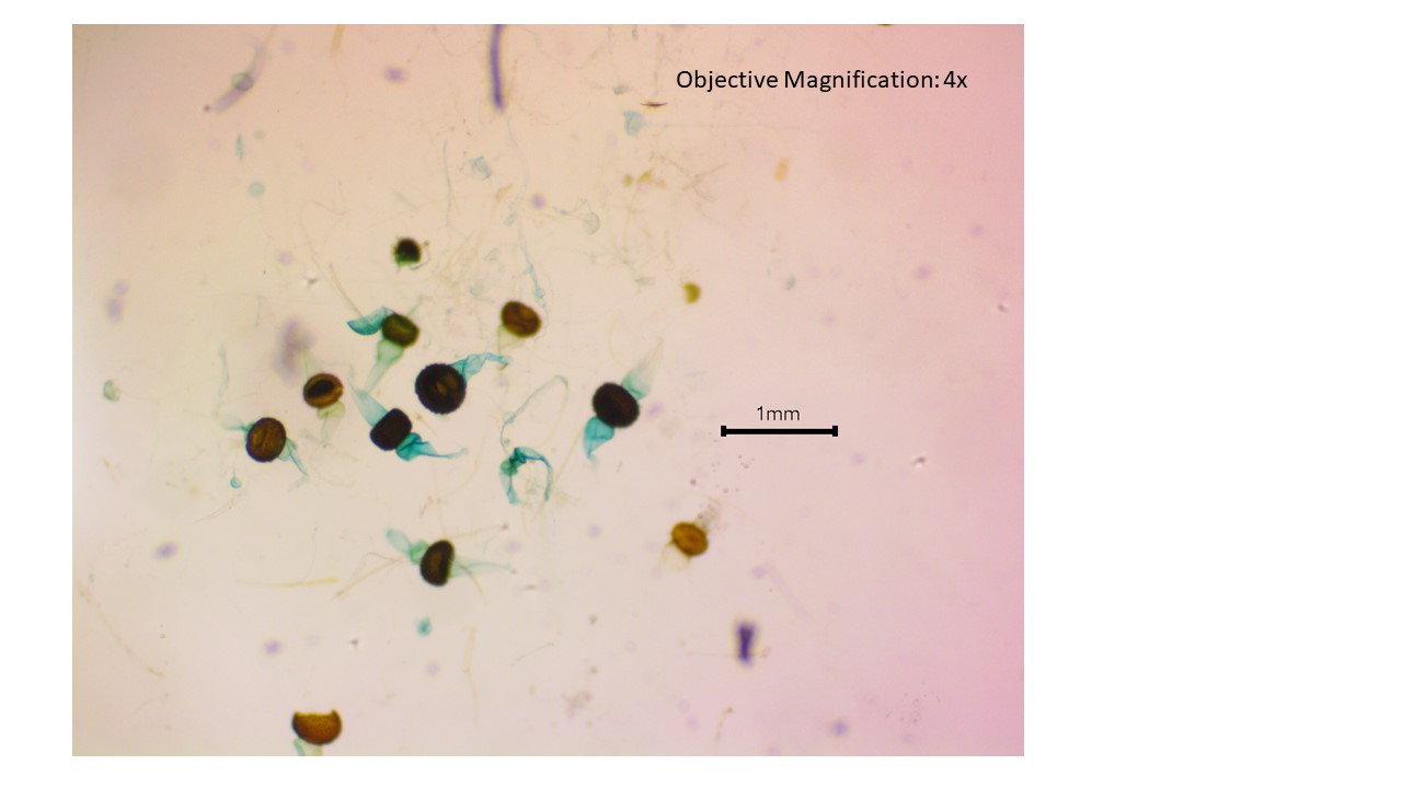 <p>Zygomycota&nbsp;</p>